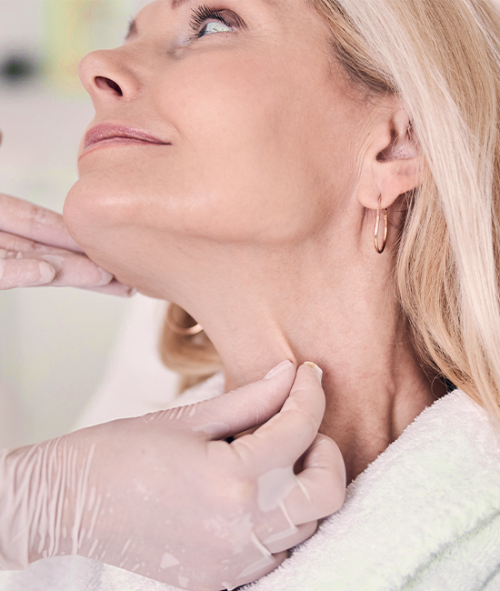 cervicoplastia deep-neck