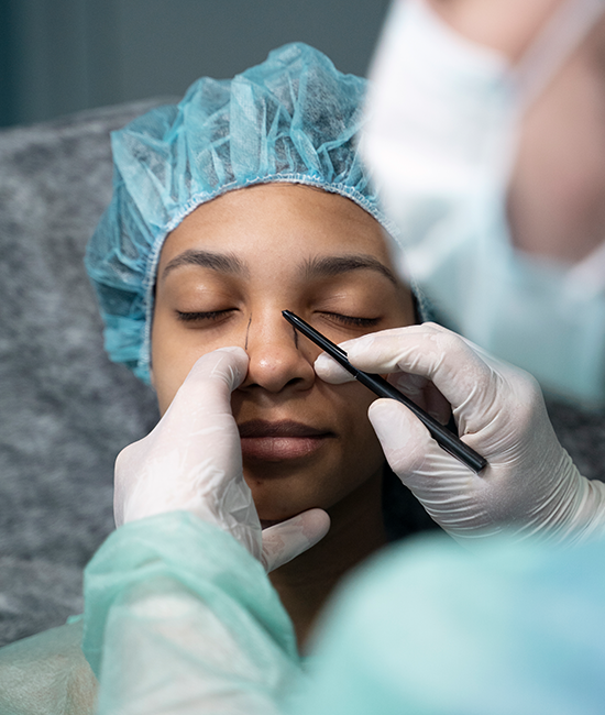 rinoplastia-natural