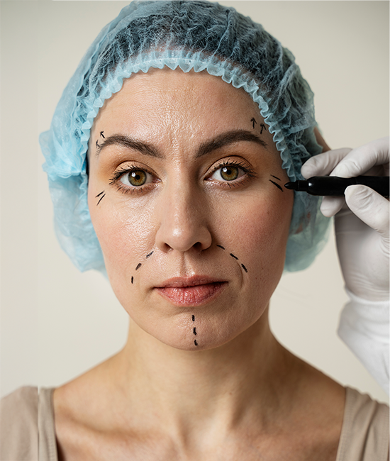 Lifting Facial Deep Plane